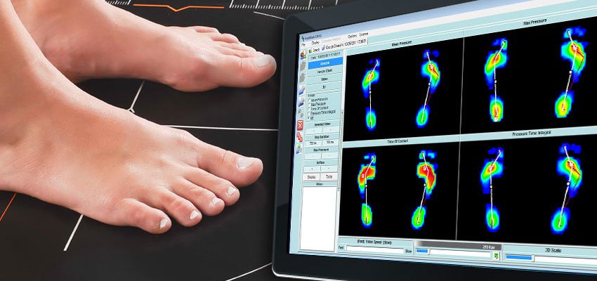 Imagem Baropodometria